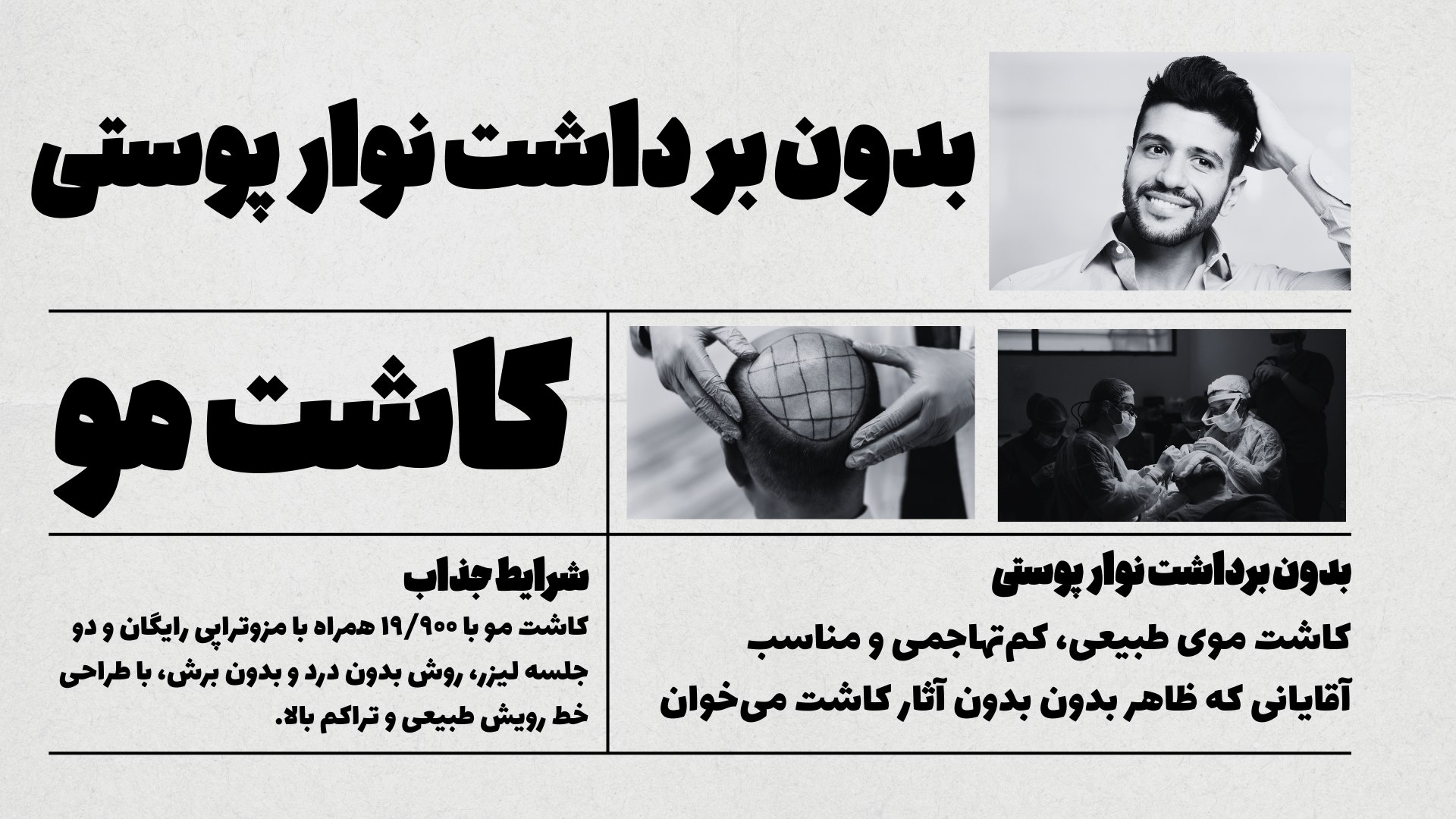 کاشت ابرو با موهای بلند👇فیلم کاشت رو ببین🥰
