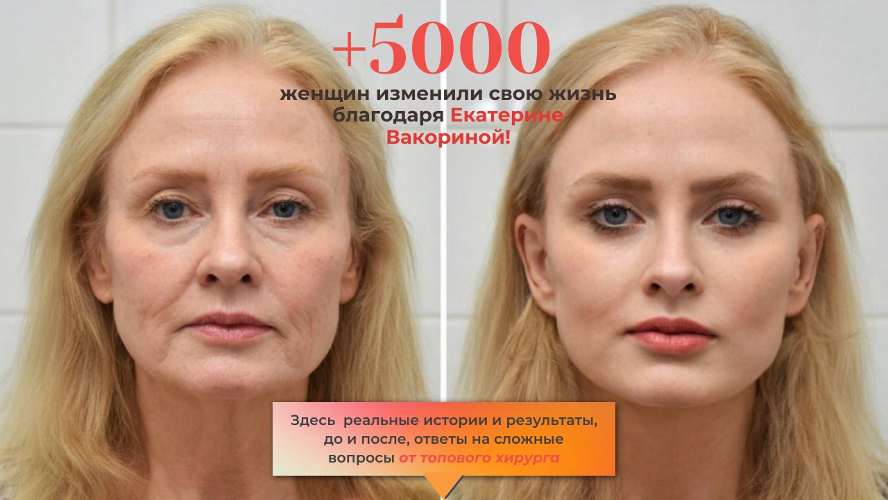 Екатерина Вакорина / Пластический хирург